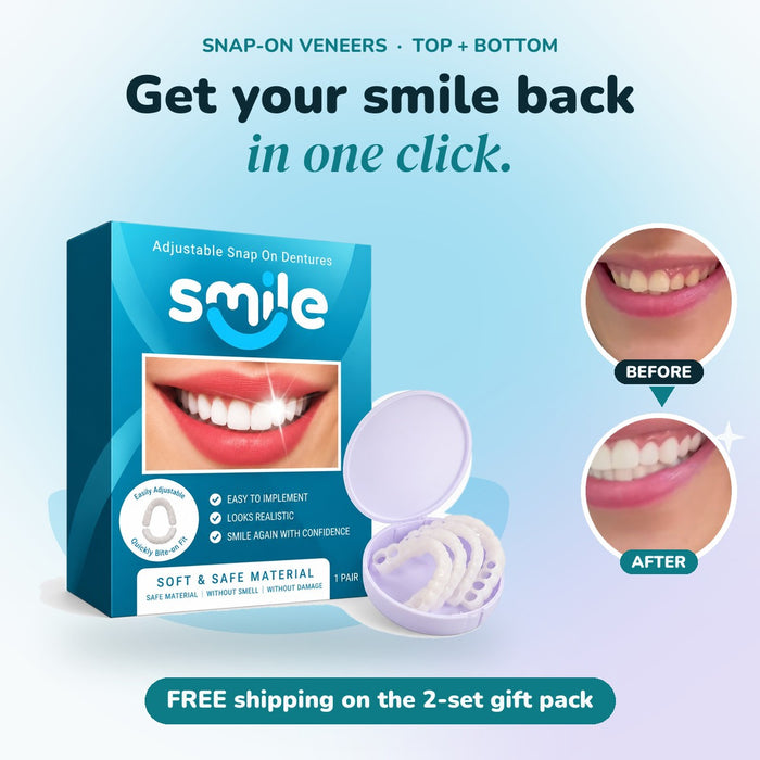 Smile Snap-On Veneers Dentures